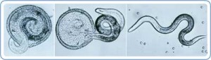 CDC website, Parasites - Toxocariasis (also known as Roundworm Infection)
